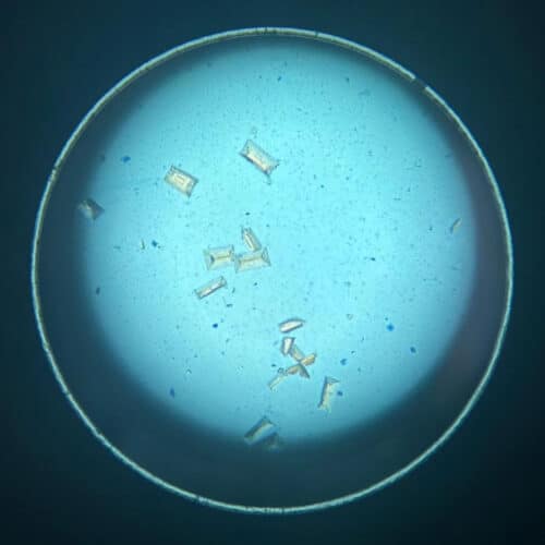 Struvite crystals in a urine sample taken at Pattenden Vets.